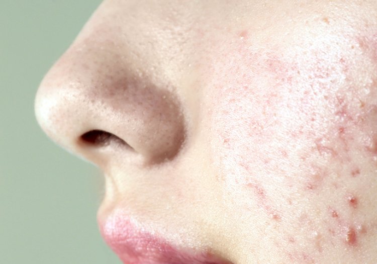 image_750x_6395cac1d6243